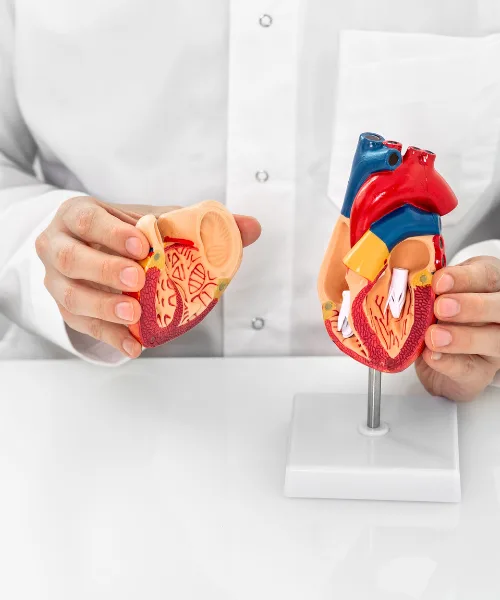 Colesterol alto: Manejo experto y salud cardiovascular en Villahermosa